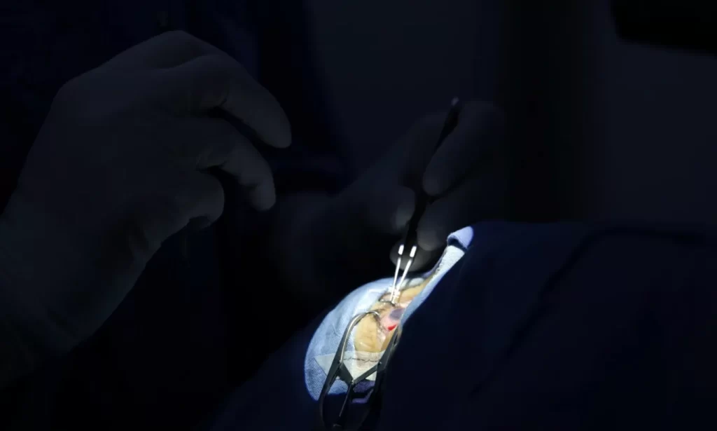 Banco de Tejido Corneal del IMSS clave para la disponibilidad y éxito de trasplantes en México
