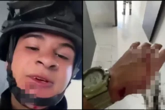 Soldado mexicano sobrevive a disparo en el rostro