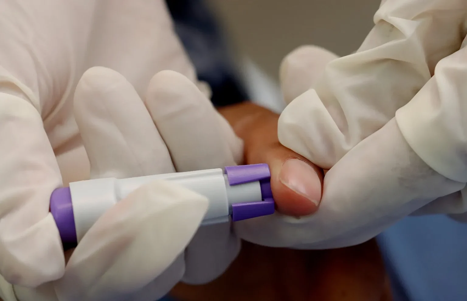 Destaca IMSS Puebla prevención y diagnóstico oportuno como claves contra la hepatitis B y C